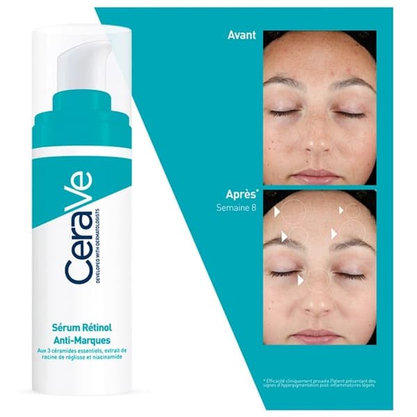 Sérum Retinol Anti-Imperfektion - CeraVe - 30ml - Icke komedogen - Hud med imperfektioner - 3 ceramider