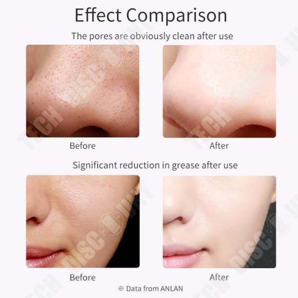 TD® Ultrasonic Facial Skin Cleaner Hudskrubber Acne Rengöring Borttagning Ultraljud Vibration Peeling Massagemaskin