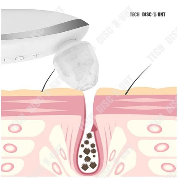 TD® Blackhead Extractor Ansiktsrengöring Dammsugare Ta bort Acne Exfoliering Bärbar elektrisk hudvård Fetttvätt