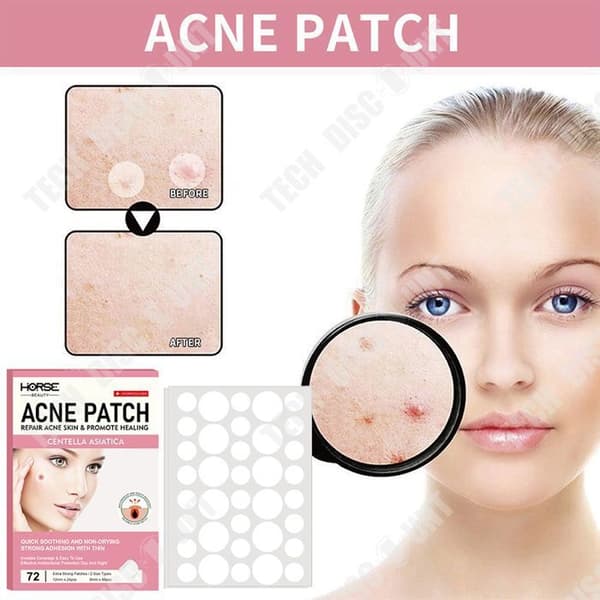 TD® Invisible Acne Patch, Acne Mark Patch, Natural Acne Removal Concealer, Acne Patch, Hydrocolloid Patch