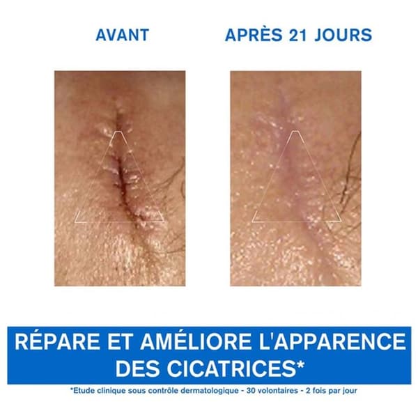 Reparativ Kräm - Uriage - Bariéderm Cica-Kräm - Koppar-Zink - 100ml - Lugnande och Fuktgivande