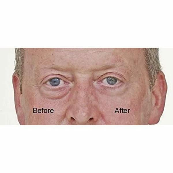 BRUGT Serum til Øjenpleje Immaculist Dermaworks (20 ml) (Refurbished A+)