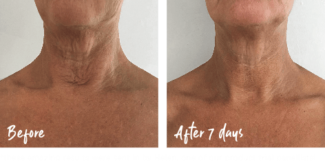 Instant Effects Kaula- ja dekoltee seerumi 30 ml