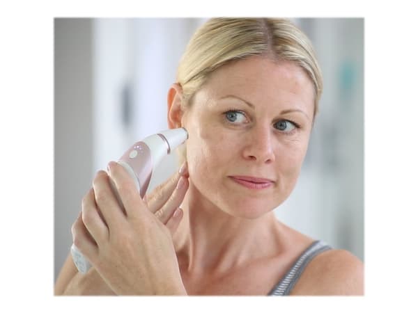 HoMedics Radiance MDA-100RG-EU - Mikrodermabrasjonssystem - trådløs