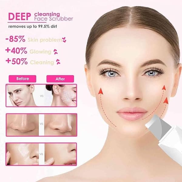 ansigtsrens ultralyd peeling, vandafvisende, rene porer - hvid