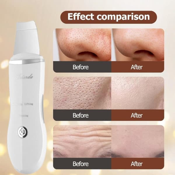 ansigtsrens ultralyd peeling, vandafvisende, rene porer - hvid