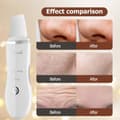Miniatyrbillede 6 af 7: ansigtsrens ultralyd peeling, vandafvisende, rene porer - hvid