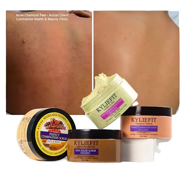 KYLIEFIT Naturlig Exfolierende Scrub, Velegnet til Alle Hudtyper, Hydrerende Formel,Pakke med 4