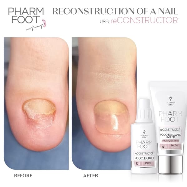 Pharm foot - reCONSTRUCTOR PODO nail set - Victoria Vynn