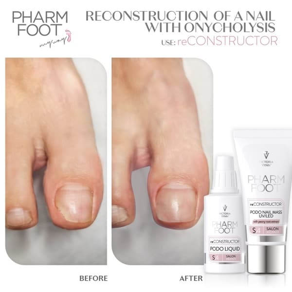 Pharm foot - reCONSTRUCTOR PODO nail set - Victoria Vynn