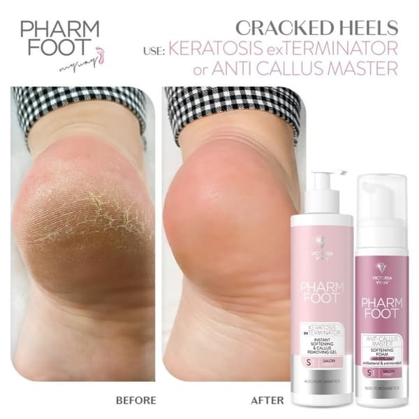 Pharm Foot - Anti Callus Master - 200ml