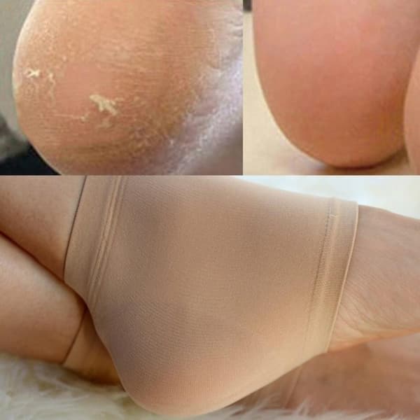 Hälskydd i Silikon - Storlek 39-43 - Beige