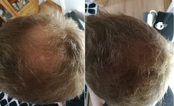Caboki - Dark Brown - Mørkebrun -  25g