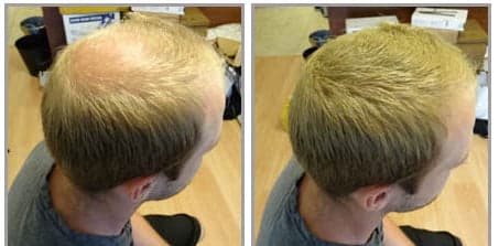 TEST HÅRFIBER - JASON BY SWEDEN - 4G -  MELLANBLOND- MEDIUM BLONDE