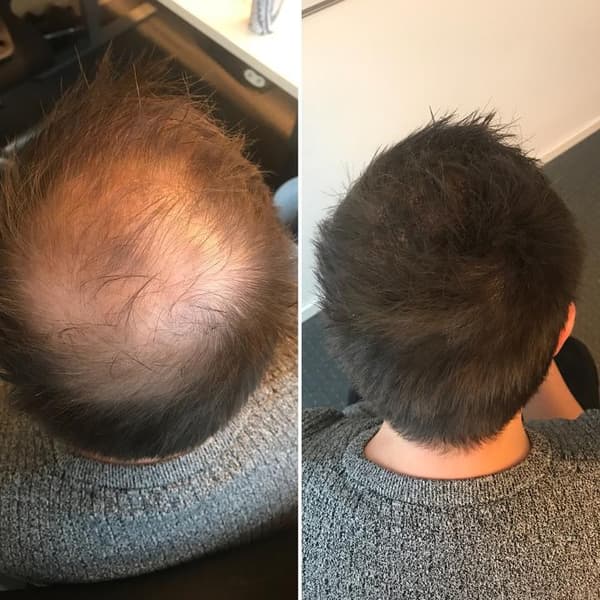 Jason By Sweden genopfyldning Hårfibre 30g - Mørkebrun