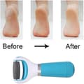 Pikkukuva 3 / 5: Electric Foot File Professional Hard Skin Remover Foot Care Ihonpoistoaine, joka poistaa halkeilevat kantapäät ja kuolleen ihon muutamassa minuutissa
