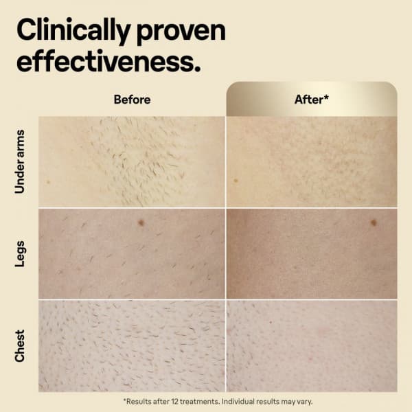 Braun IPL Silk·expert Pro 5 PL5242 IPL-enhed