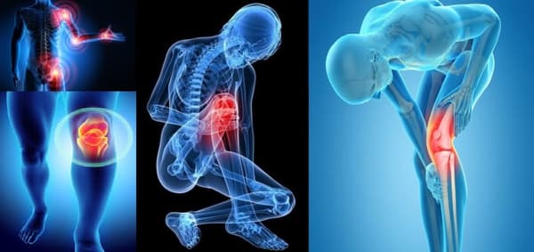 ACUPRESSURE BAND VÄHENTÄÄ POLVIKIPUA BEAKTIIVISESTI