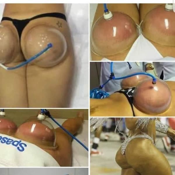 Bröst- och rumpaförbättringspump Lyftande Vakuumsugkoppning Sugbehandlingsanordning A55440
