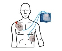 Elektrodekassette voksen Philips HeartStart HS1