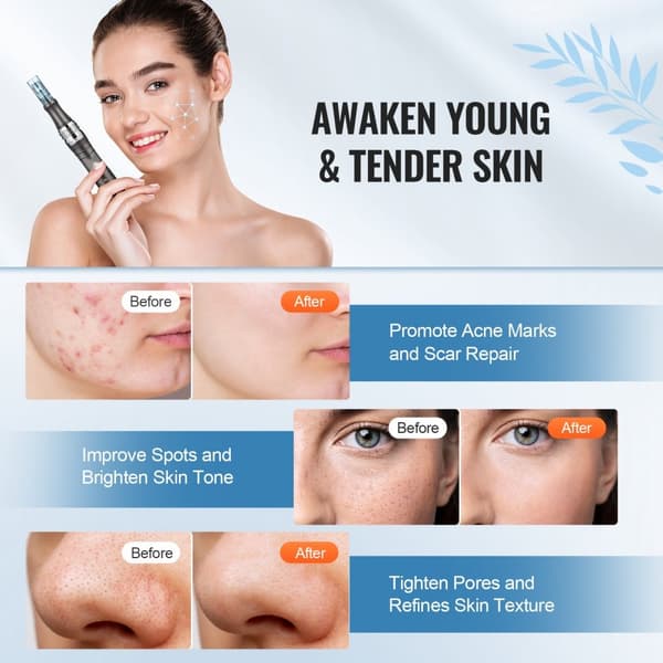 Professionell Microneedling Pen, Elektrisk Skönhetspenna med 6 Nålar, Justerbara 6 Hastigheter, Hudförbättring