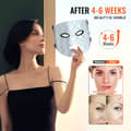 Miniatyrbillede 5 af 9: Rødt Lys Terapi Maske 7-farvet LED Ansigtsmaske Lysbehandling med 850nm NIR, effektiv hudbehandling, anti-aging, hjemmebrug