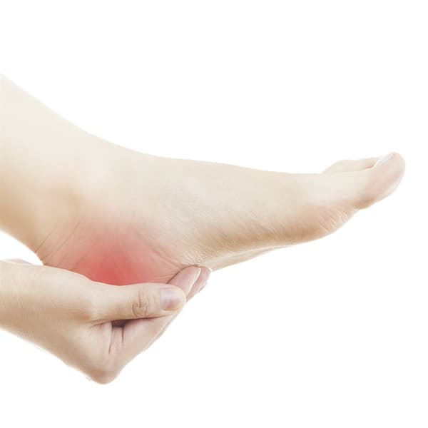 Hälkopp i Silicon för plantarfasciit