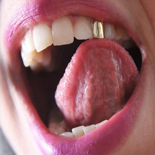 Black Grillz hampaasta - a $ ap hiphop -hammastikku