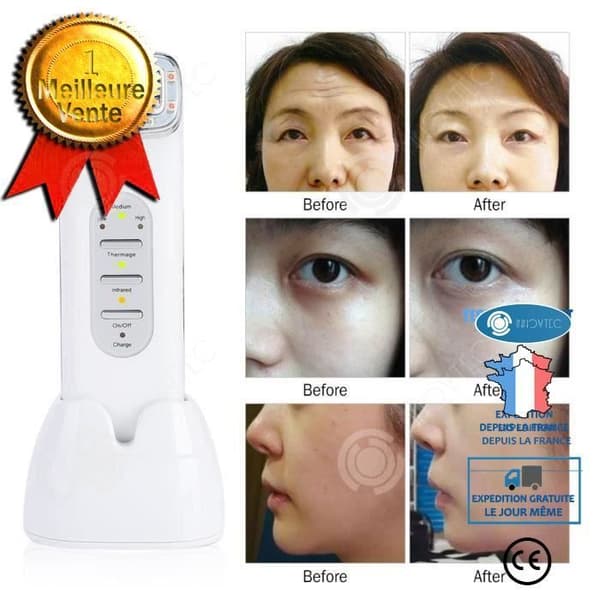 INNOVTEC radiofrekvens ansiktsmassagemaskin - Hudföryngring - Anti-aging - Anti-rynkor - Vit