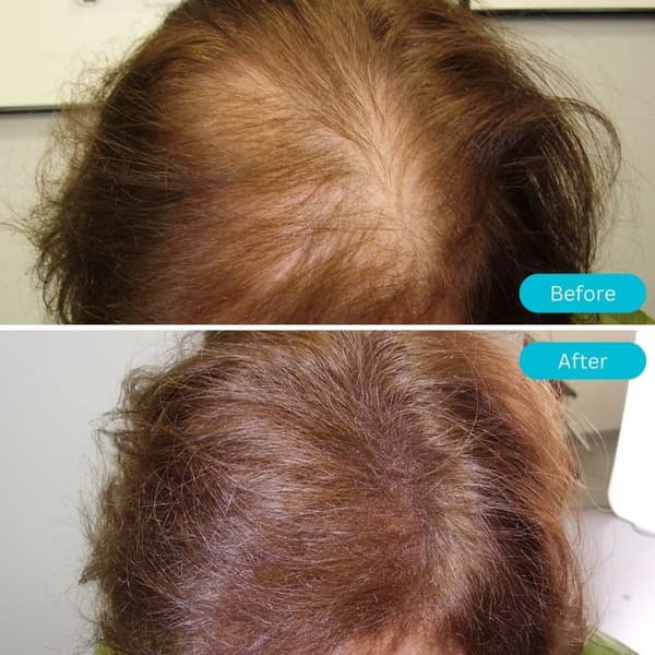 Hair Pro Lys Blond