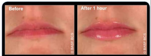 Instant Effects Lip Plumper läppserum 5 ml
