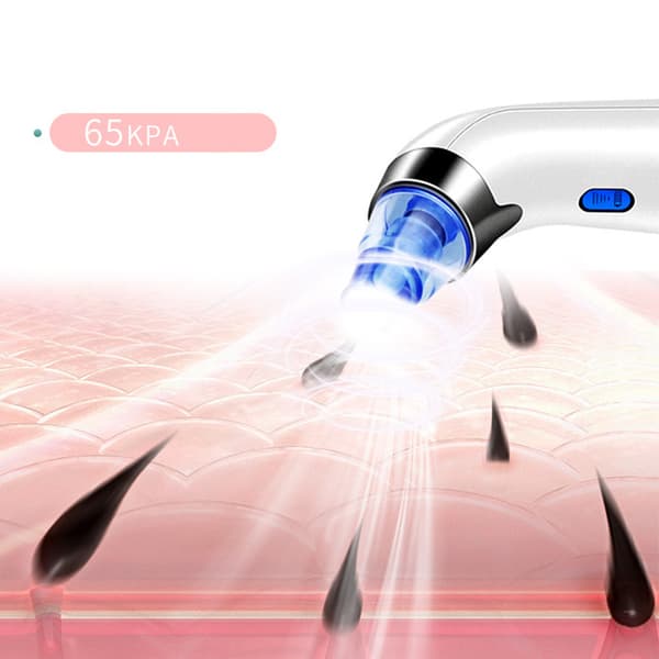 INF Blå og hvit Blackhead Remover - Perfekt for pore-rensing