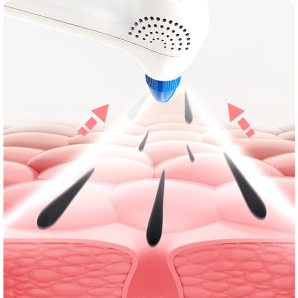 INF Whitehead Remover - White - Pore Vacuum Cleaner