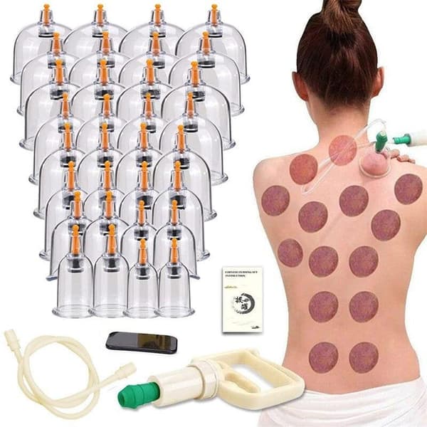 Cupping - Akupunktur - Kinesisk medicin - 32 kopper