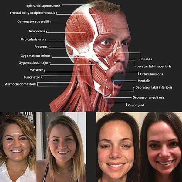 INF Jawline trainer - leuan treenaus silikoni musta   1 Pack