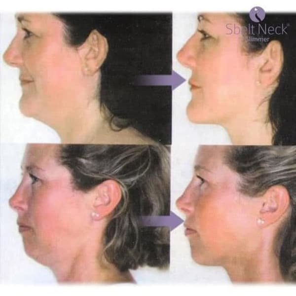 CBER07149-Double Chin Reducer och Nack Massager Bälte Nacke smalare