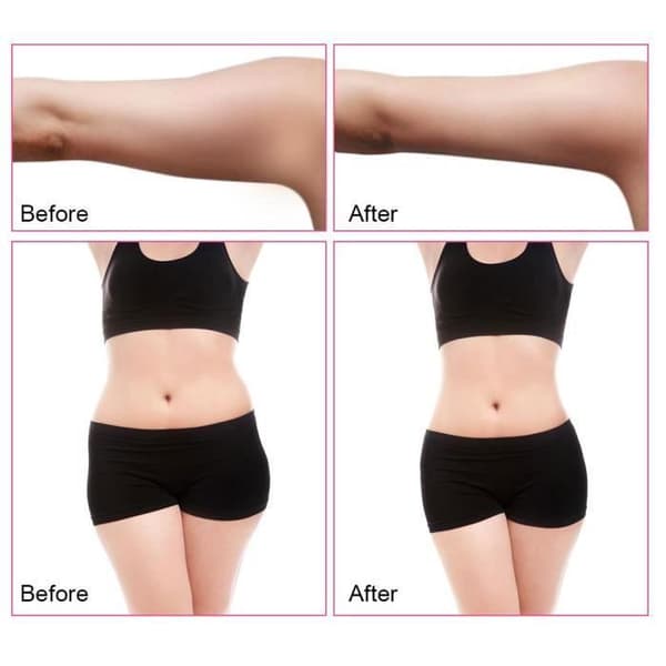 Ultraljudskavitationsmaskin för att ta bort celluliter - TEKNISK RABATT - EU-plugg