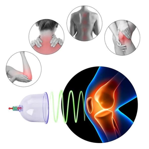Set för terapi med koppar - Cupping Cups - Kinesisk massage - 12 koppar - Medicinsk sugpistol