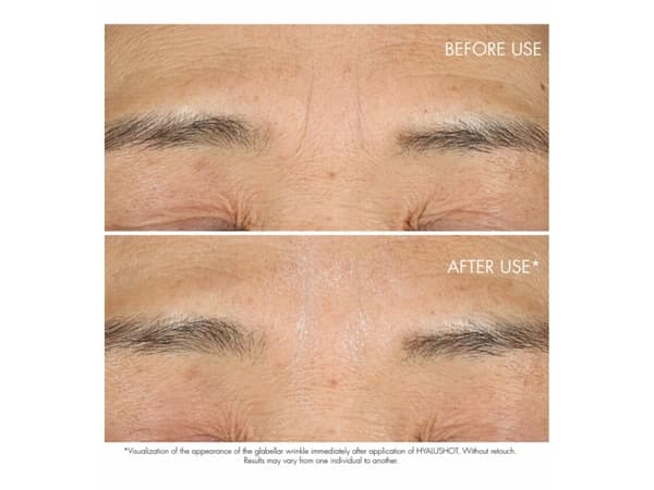 DIOR CAPTURE TOTALE HYALUSHOT FILLER 15ML