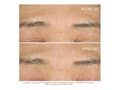 Miniatyrbilde 4 av 5: DIOR CAPTURE TOTALE HYALUSHOT FILLER 15ML