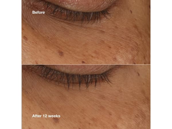 Clinique All About Eyes Illuminating Concentrated Serum - - 10 ml