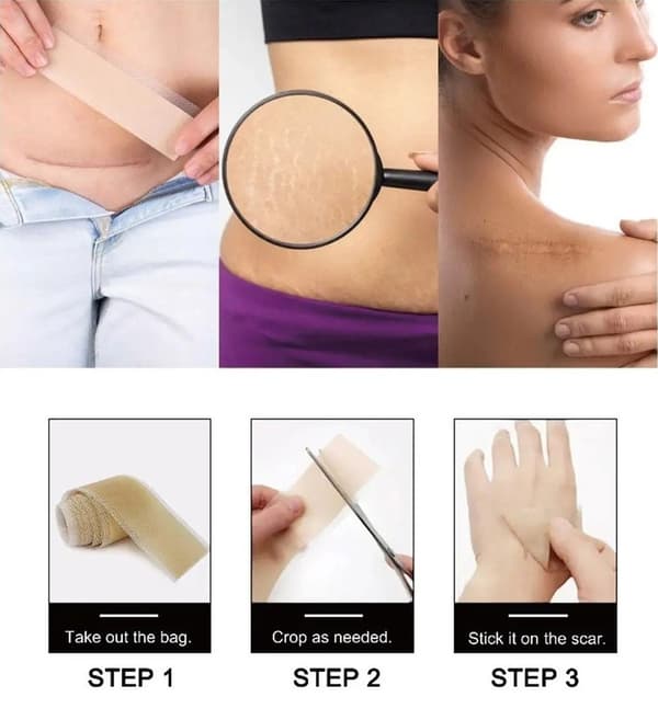 Silikontape / Plaster for Arr – Behandling av arr