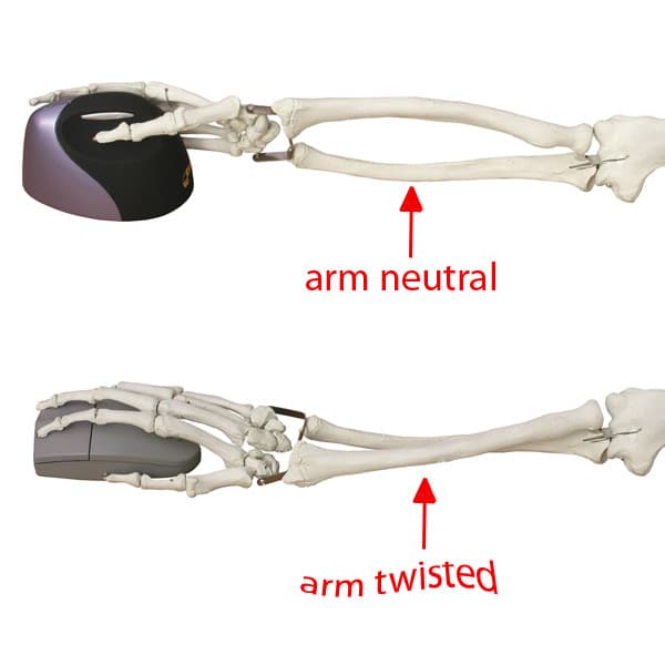 Evoluent Vertical Mouse4 WL Right hand (500788)