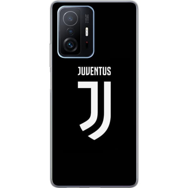 Xiaomi 11T Gennemsigtig cover Juventus