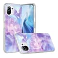 Miniatyrbillede 1 af 5: SKALO Xiaomi Mi 11 Lite Marmor TPU-cover - #1