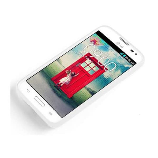 Deksel til LG L70 (1. SIM) Cover av fleksibelt TPU-silikon i X-Line-design