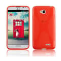Miniatyrbillede 1 af 4: LG L70 (1. SIM) Etui Case Cover ()
