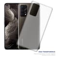 Miniatyrbillede 3 af 6: Realme GT Master Cover Case Etui (Gennemsigtig)