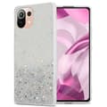 Miniatyrbild 1 av 6: Xiaomi Mi 11 LITE (4G / 5G) / 11 LITE NE Skal Fodral Case Cover av flexibelt TPU-silikon med glittrande glitter