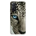 Miniatyrbild 1 av 6: Tryckt silikonfodral kompatibelt Xiaomi Redmi Note 11 Pro Plus 5G Leopard Eye